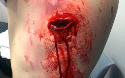 Moulage en simulación clínica: cuando el realismo marca la diferencia