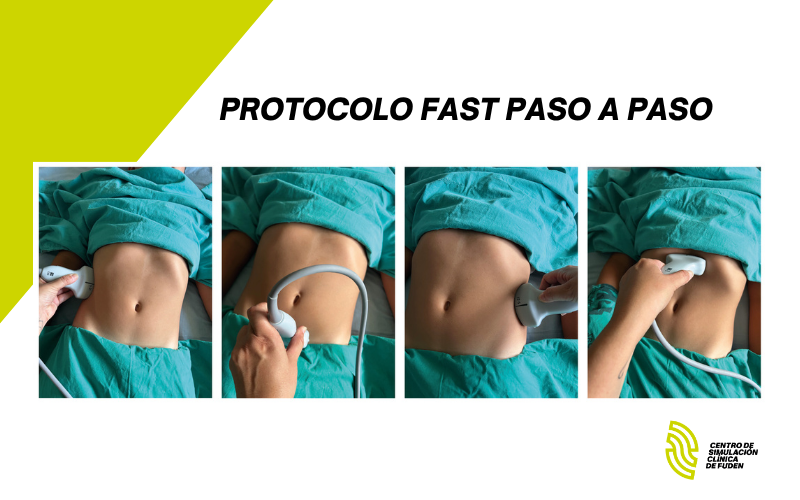 protocolo FAST paso a paso