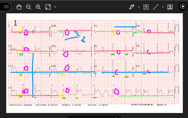 taller-electrocardiografia-practica-