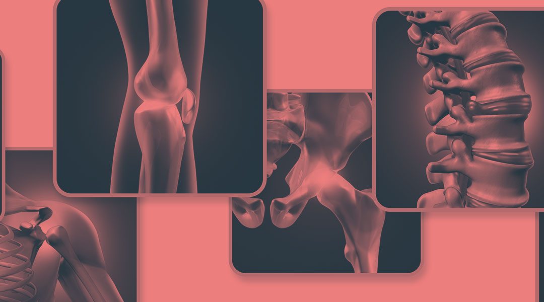 Fisioterapia y dolor: prevención y manejo