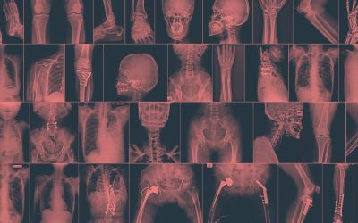 La importancia de la imagen clínica en fisioterapia