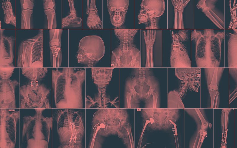 imagen clinica en fisioterapia