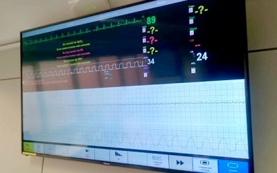 Registro cardiotocográfico: formación exclusiva para matronas