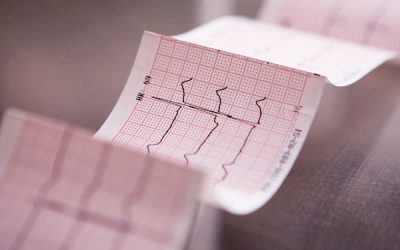 Nueva edición del curso online Introducción a la lectura electrocardiográfica acreditado por ACSA