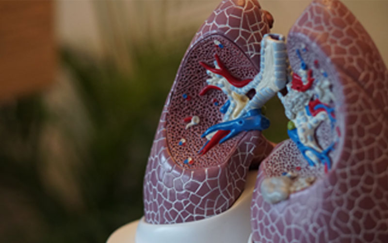 Experto en Fisioterapia Respiratoria: trabaja en lo que te apasiona