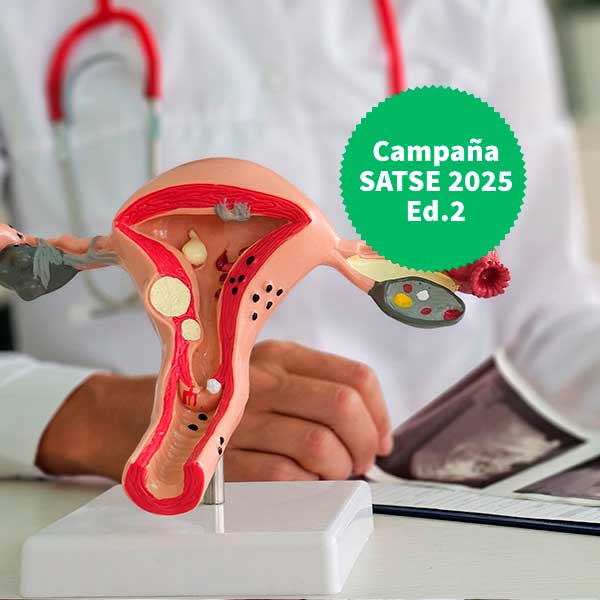 experto-satse-2